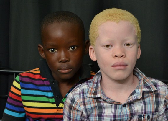 albinos áfrica