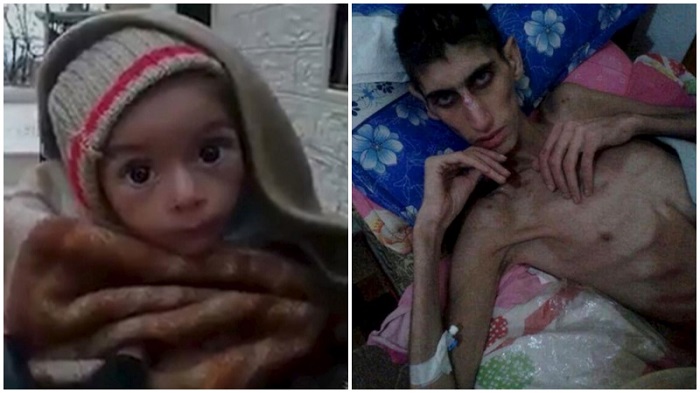 Sírios estão morrendo fome Madaya