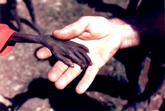 africa fome miseria