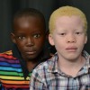 albinos-africa