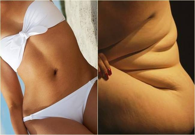 E quando o 'corpo padrão' não se encaixa no 'padrão de beleza'?