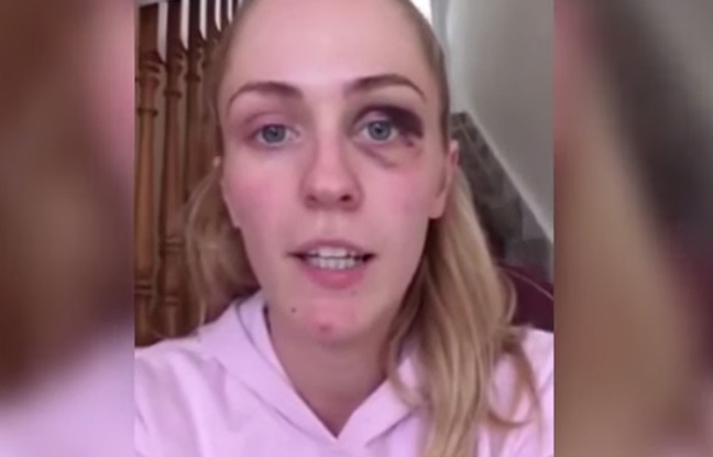 emma vítima de violência doméstica mulheres vídeo inspirador