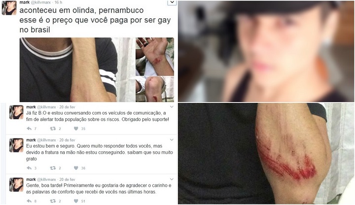 Universitário vítima de homofobia jovem gay olinda agredido carnaval