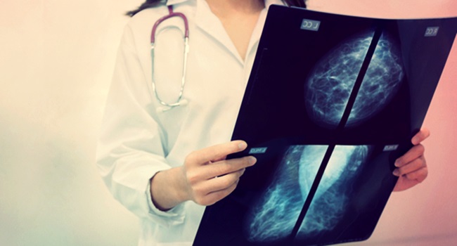 médicos recém-formados ler uma mamografia