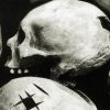 Incas praticavam cirurgias mais bem sucedidas que médicos do século 19 incas-praticavam-cirurgias-mais-bem-sucedidas-que-medicos-do-seculo-19