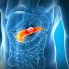 pesquisadores-da-usp-criam-biossensor-que-detecta-cancer-de-pancreas