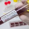 coronavirus-vacina