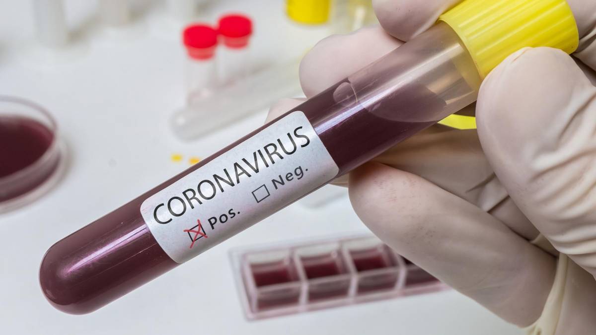 vacina coronavírus cuba