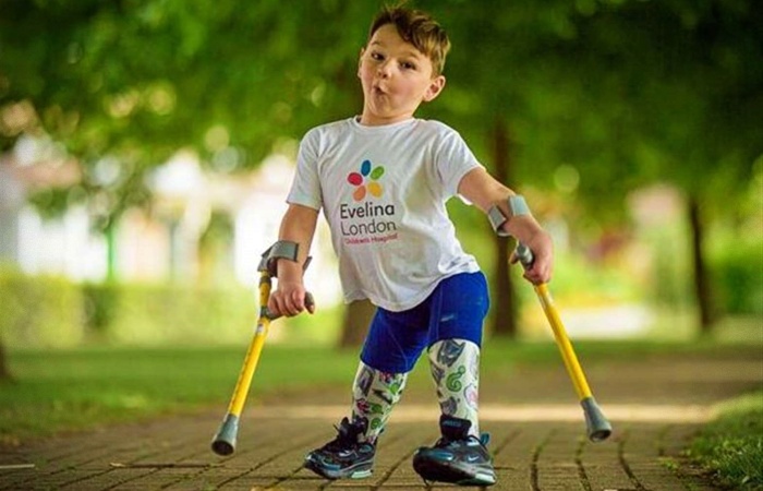 Menino pernas amputadas torturado pais inspira projeto de lei