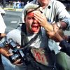 fotografo-perdeu-olho-protesto-anos-luta-indenizacao