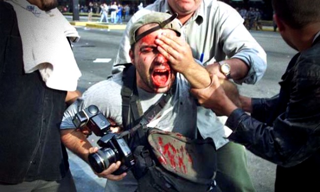 Fotógrafo perdeu olho protesto luta indenização são paulo