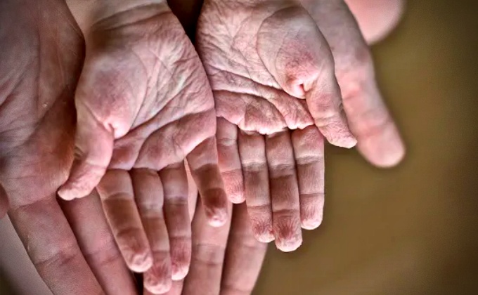 Cientistas desvendam benefícios impressionantes dedos enrugados água