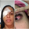 Todas as pomadas modeladoras estão proibidas pela Anvisa após casos de cegueira temporária pomadas-cegueira-cosmetico