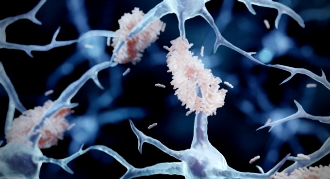 Proteína longevidade combate inflamação evita morte neurônios novo estudo