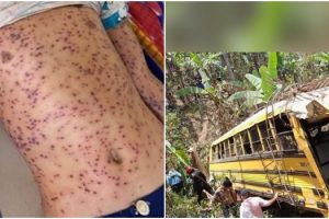 abelhas-africanizadas-ataque