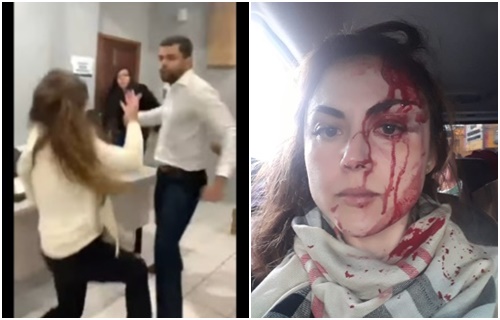 procurador espancou chefe