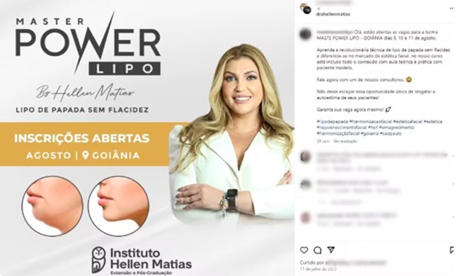  Dentista influencer presa deformar pacientes cirurgias estéticas